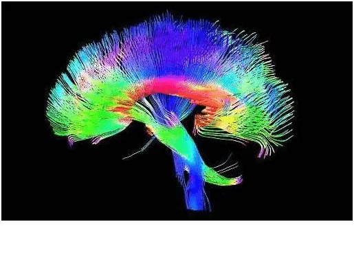 Diffuse Tensor Imaging