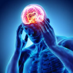 headaches after concussion