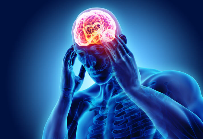 headaches after a concussion
