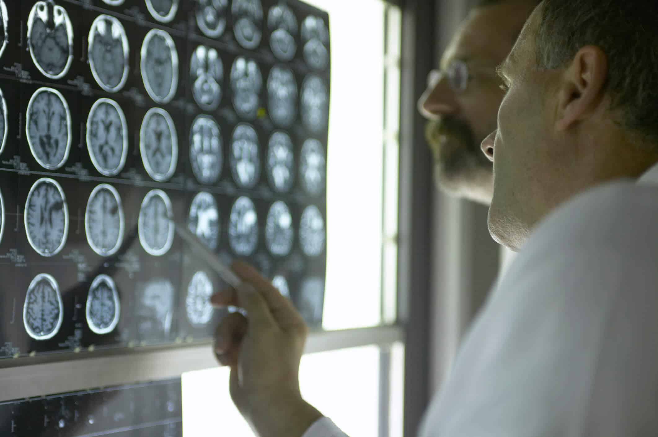 traumatic brain injury technology