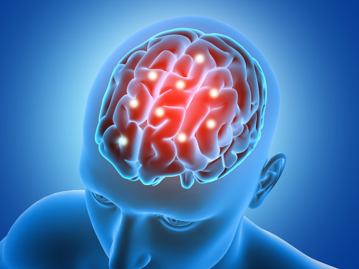 Brain injuries Can Cause Epilepsy
