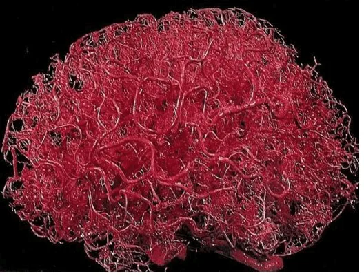 Brain Injury