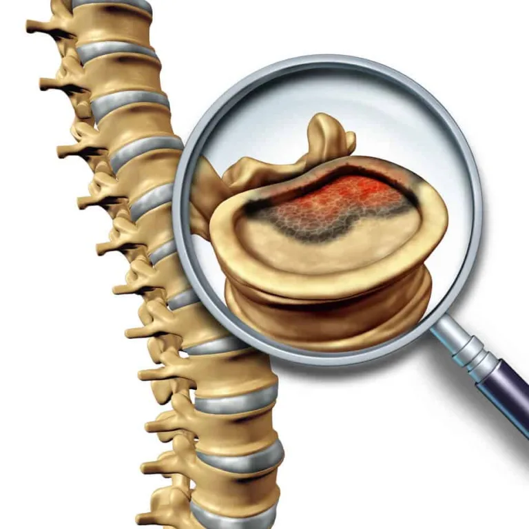 spine injuries