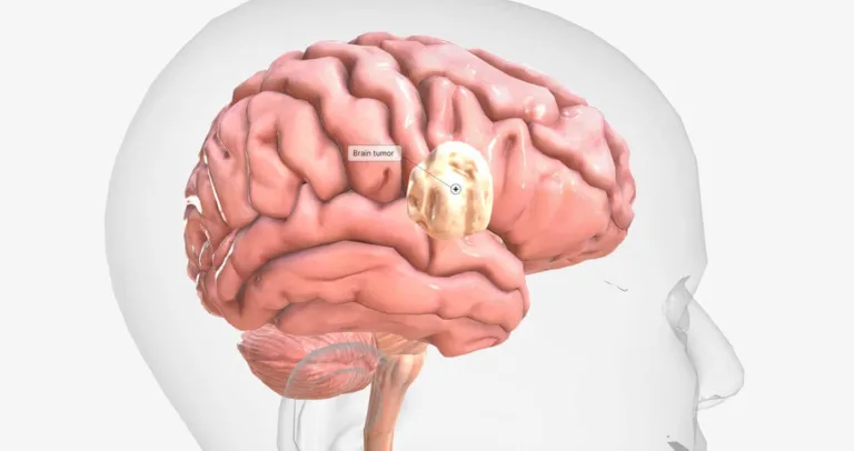 how long for concussion symptoms to start
