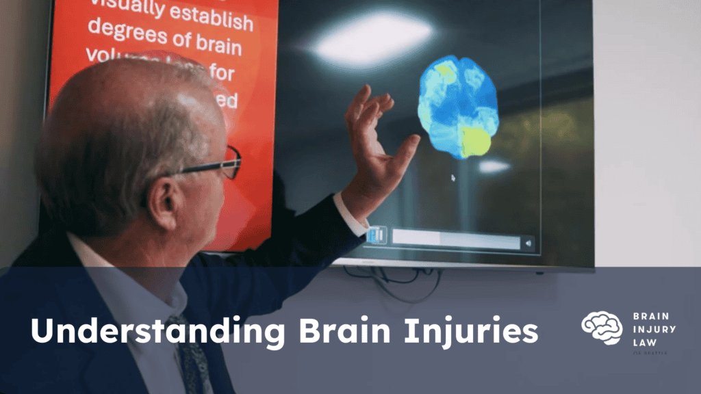 understanding brain injuries (2)