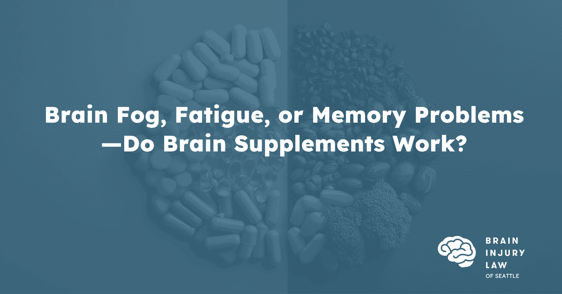 Brain Supplements Blog