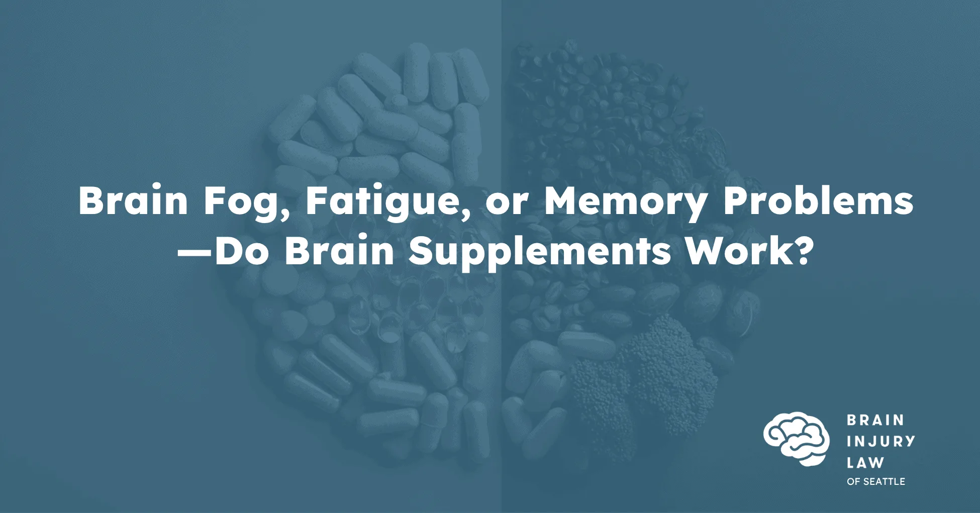 Brain Supplements Blog